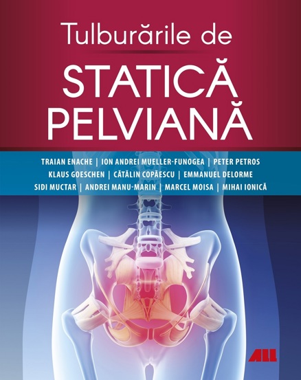 Tulburari de statica pelviana